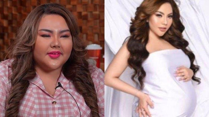 Lisa Rogoh Rp90 Juta Demi Operasi Bariatrik