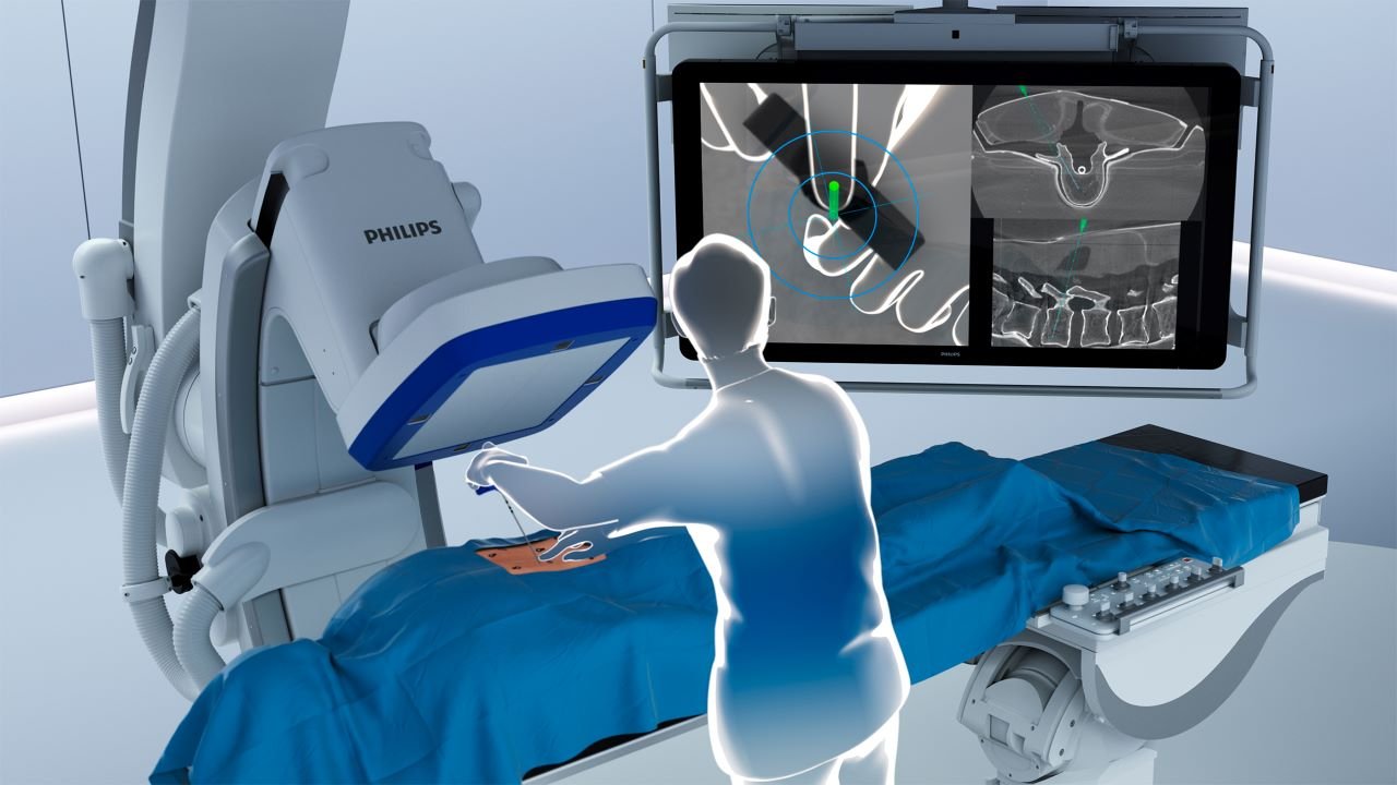 Augmented Reality Surgical Navigation: Merevolusi Presisi dan Keamanan Operasi